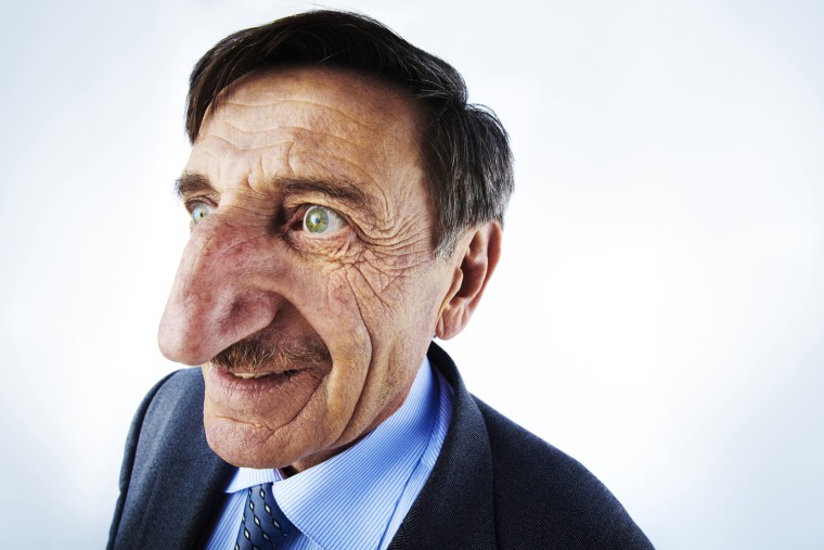 Mehmet Ozyurek - Longest Nose
Guinness World Records 2010
Photo Credit: Paul Michael Hughes/Guinness World Records
Location: Rome, Italy